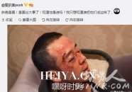 杨坤被打受伤是怎么回事  杨坤被打现场照片原因真相揭秘